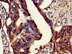 ETHE1 Polyclonal Antibody