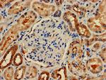 ETNK1 Antibody in Immunohistochemistry (Paraffin) (IHC (P))
