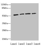 ETNK1 Antibody in Western Blot (WB)