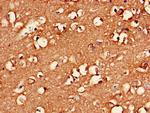 EXO1 Antibody in Immunohistochemistry (Paraffin) (IHC (P))