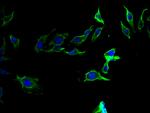 Prothrombin Polyclonal Antibody