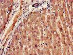 FADS1 Antibody in Immunohistochemistry (Paraffin) (IHC (P))