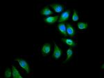 eIF3d Antibody in Immunocytochemistry (ICC/IF)