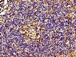 eIF3d Antibody in Immunohistochemistry (Paraffin) (IHC (P))