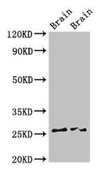 FAM3B Antibody in Western Blot (WB)
