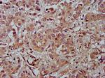 Fibulin 2 Antibody in Immunohistochemistry (Paraffin) (IHC (P))