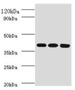FCGRT Polyclonal Antibody