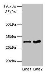 FGFR1OP2 Polyclonal Antibody