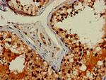 FIBP Antibody in Immunohistochemistry (Paraffin) (IHC (P))