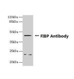 FIBP Antibody in Western Blot (WB)