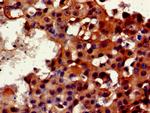 FKBP25 Antibody in Immunohistochemistry (Paraffin) (IHC (P))