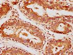 SULT1A3 Antibody in Immunohistochemistry (Paraffin) (IHC (P))