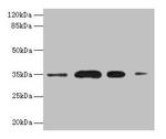 SULT1A3 Antibody in Western Blot (WB)