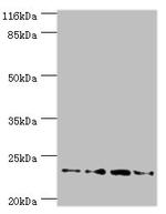 FXN Polyclonal Antibody