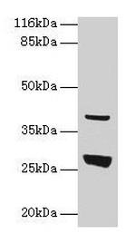 GAMT Polyclonal Antibody