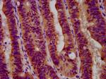 GBA Polyclonal Antibody