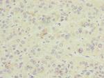 GDAP1 Polyclonal Antibody