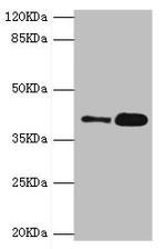 GDAP1 Antibody in Western Blot (WB)