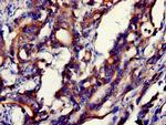 GDI2 Polyclonal Antibody