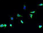 TSTA3 Polyclonal Antibody