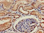 TSTA3 Antibody in Immunohistochemistry (Paraffin) (IHC (P))