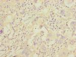 GGTLC2 Polyclonal Antibody