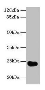 GGTLC2 Antibody in Western Blot (WB)