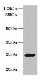 GH2 Antibody in Western Blot (WB)