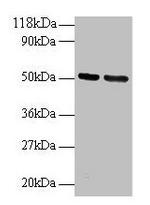 GDI2 Polyclonal Antibody