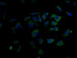 GLP1R Polyclonal Antibody