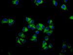 GNA12 Polyclonal Antibody