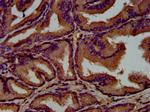 GNAL Antibody in Immunohistochemistry (Paraffin) (IHC (P))