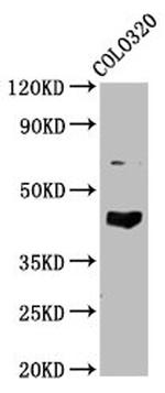 GNAL Antibody in Western Blot (WB)