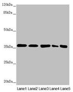 GNB2 Antibody in Western Blot (WB)