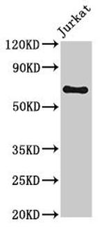 GNL1 Antibody in Western Blot (WB)