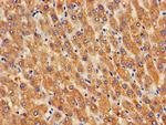 GOSR2 Polyclonal Antibody