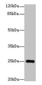 GOSR2 Antibody in Western Blot (WB)