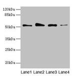 GSDMD Antibody in Western Blot (WB)