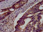 GSS Antibody in Immunohistochemistry (Paraffin) (IHC (P))