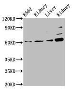 GSS Antibody in Western Blot (WB)