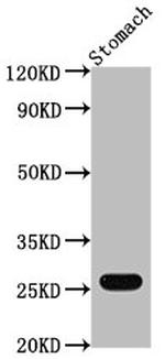 GSTA1 Polyclonal Antibody