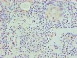 HAT1 Polyclonal Antibody