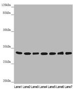 HCCS Polyclonal Antibody