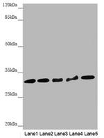 HCCS Polyclonal Antibody