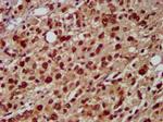 hnRNP AB Antibody in Immunohistochemistry (Paraffin) (IHC (P))