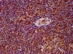 hnRNP AB Antibody in Immunohistochemistry (Paraffin) (IHC (P))