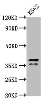 hnRNP AB Antibody in Western Blot (WB)