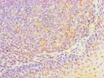 HOXA1 Polyclonal Antibody