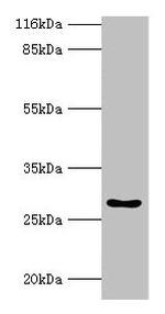 HOXA6 Antibody in Western Blot (WB)