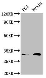 HOXD8 Polyclonal Antibody